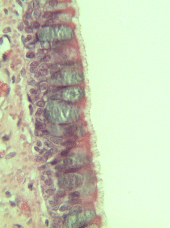 pseudostratified epithelium