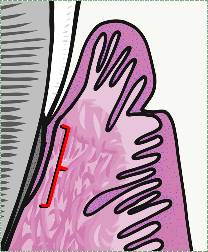 junctional epithelium